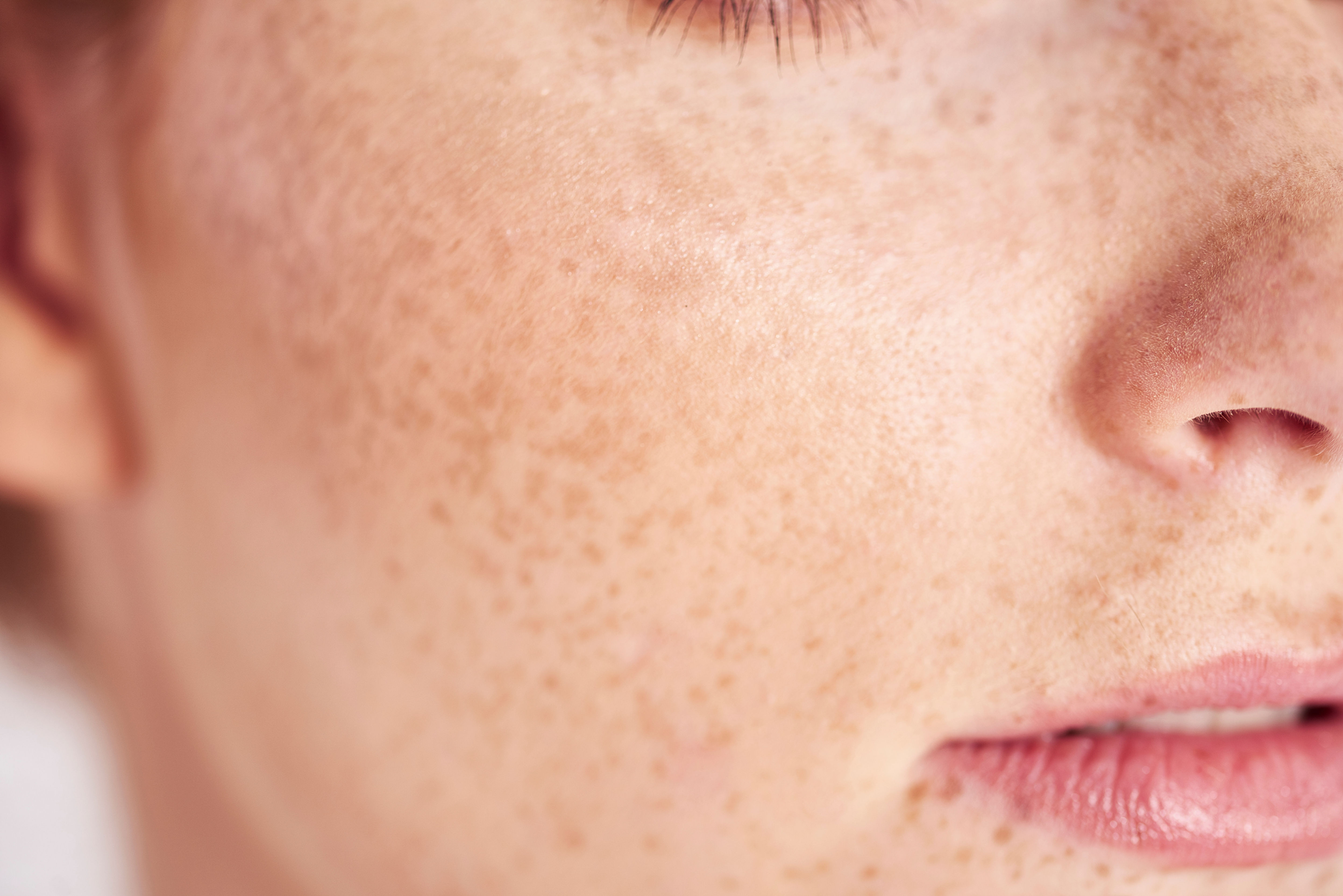 Faux freckles